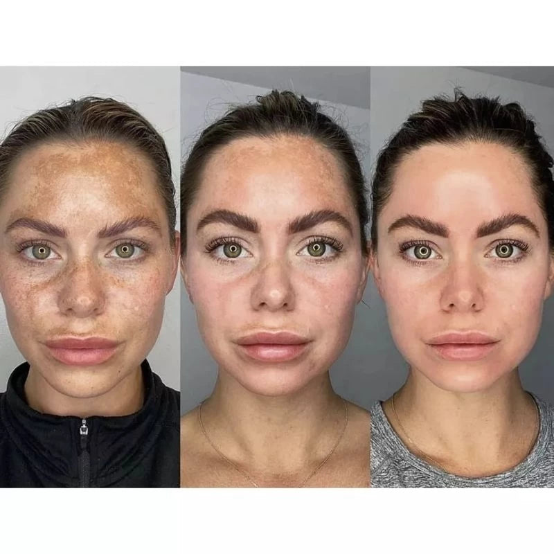 Sérum Clareador de Melasma Com Ácido Mandélico Original