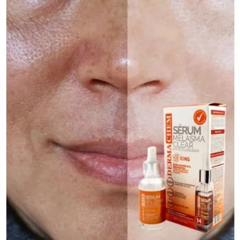 Sérum Clareador de Melasma Com Ácido Mandélico Original